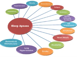 Sleep Apnea chart