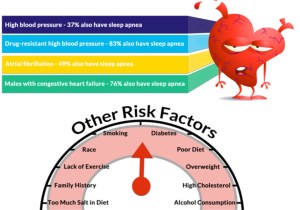 Sleep Apnea Risk Factors